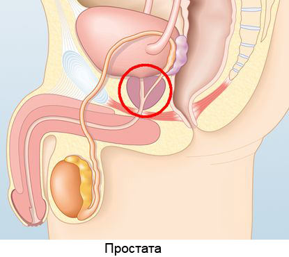 Аденома предстательной железы рекомендации